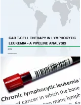 CAR T-cell therapy in Lymphocytic Leukemia - A Pipeline Analysis Report
